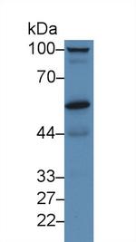 PRCP Antibody in Western Blot (WB)