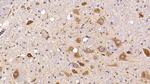 PSAP Antibody in Immunohistochemistry (Paraffin) (IHC (P))