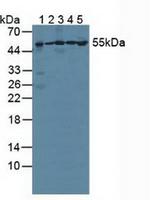 PSMC1 Antibody in Western Blot (WB)