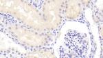 PSMD6 Polyclonal Antibody