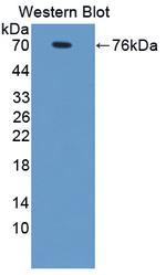 PSMD6 Antibody in Western Blot (WB)