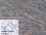 PSMD9 Antibody in Immunohistochemistry (Paraffin) (IHC (P))