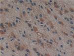 PSMD9 Antibody in Immunohistochemistry (Paraffin) (IHC (P))