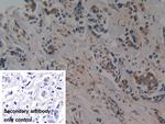 PSMD9 Antibody in Immunohistochemistry (Paraffin) (IHC (P))