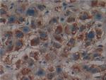 PSMD9 Polyclonal Antibody
