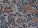 PSMD9 Antibody in Immunohistochemistry (Paraffin) (IHC (P))