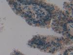 PSMD9 Antibody in Immunohistochemistry (Paraffin) (IHC (P))