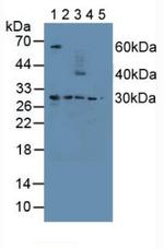 PSMD9 Antibody in Western Blot (WB)