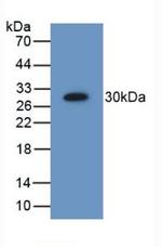 PSMD9 Antibody in Western Blot (WB)