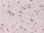 PSMA5 Antibody in Immunohistochemistry (Paraffin) (IHC (P))