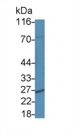 PSMA5 Antibody in Western Blot (WB)