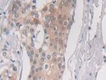 PSMB6 Antibody in Immunohistochemistry (Paraffin) (IHC (P))