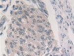 PSMB6 Polyclonal Antibody