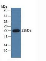 PSMB6 Antibody in Western Blot (WB)