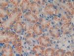 PSMB9 Polyclonal Antibody