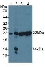 PSMB9 Antibody in Western Blot (WB)