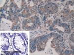 ERp72 Antibody in Immunohistochemistry (Paraffin) (IHC (P))