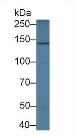 SCAF11 Antibody in Western Blot (WB)