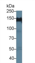 PPFIA1 Antibody in Western Blot (WB)