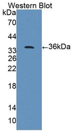 PPFIA1 Antibody in Western Blot (WB)