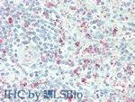 PTPRB Antibody in Immunohistochemistry (Paraffin) (IHC (P))