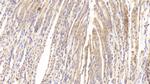 PTPRB Polyclonal Antibody