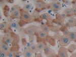 PTPRH Polyclonal Antibody