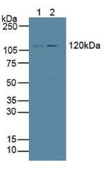 PTPRH Antibody in Western Blot (WB)