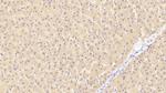 PTPRH Polyclonal Antibody