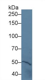 PTPRH Antibody in Western Blot (WB)