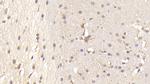 PTPRS Polyclonal Antibody