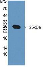 PRL3 Antibody in Western Blot (WB)