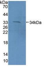 PCDH15 Polyclonal Antibody