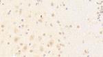 PCDHA1 Antibody in Immunohistochemistry (Paraffin) (IHC (P))