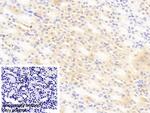 PCDHA1 Antibody in Immunohistochemistry (Paraffin) (IHC (P))