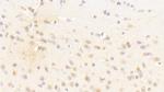 PCDHA1 Antibody in Immunohistochemistry (Paraffin) (IHC (P))