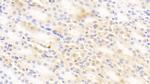 PCDHA1 Antibody in Immunohistochemistry (Paraffin) (IHC (P))