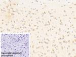 PCDHA1 Antibody in Immunohistochemistry (Paraffin) (IHC (P))