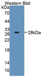 PCDHA1 Antibody in Western Blot (WB)