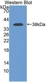 PCDHB15 Antibody in Western Blot (WB)