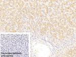NPEPPS Polyclonal Antibody