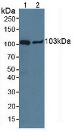 NPEPPS Antibody in Western Blot (WB)