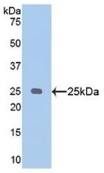 NPEPPS Antibody in Western Blot (WB)