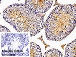 NPEPPS Antibody in Immunohistochemistry (Paraffin) (IHC (P))
