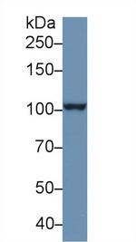 NPEPPS Antibody in Western Blot (WB)