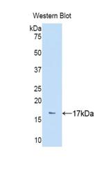 NPEPPS Antibody in Western Blot (WB)