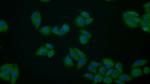 PKM2 Polyclonal Antibody