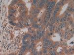 PKM2 Antibody in Immunohistochemistry (Paraffin) (IHC (P))