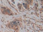 PKM2 Antibody in Immunohistochemistry (Paraffin) (IHC (P))