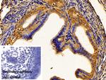 PKM2 Antibody in Immunohistochemistry (Paraffin) (IHC (P))